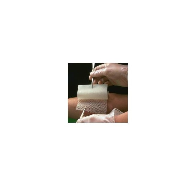 GARZA MEDICATA BACTIGRAS CON CLOREXIDINA ACETATO 0,5% 10X10CM 10 PEZZI GARZA MEDICATA BACTIGRAS CON CLOREXIDINA ACETATO 0,5% 10X10CM 10 PEZZI